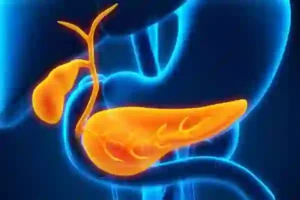 ERCP برای مجاری صفراوی و پانکراس