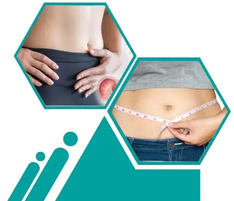 بوتاکس معده در کرج