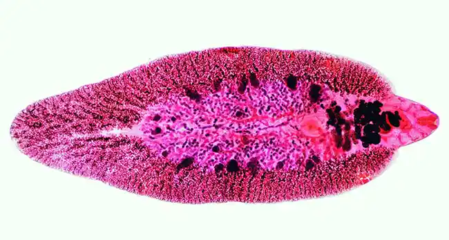 درمان انگل فاسیولا