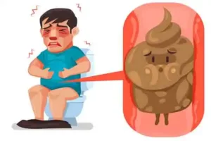 هر آنچه باید در مورد یبوست بدانیم