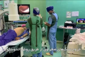 ویدیو چگونگی عملیات ERCP