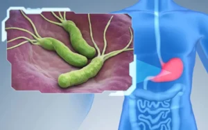 هلیکوباکتر پیلوری