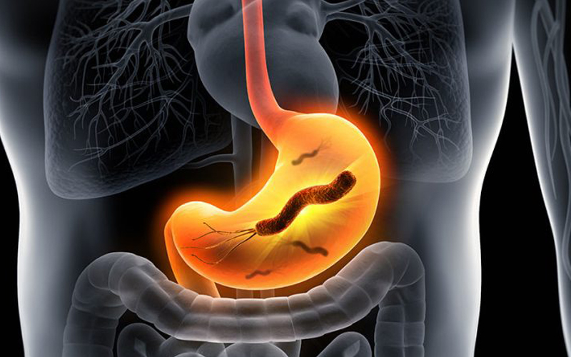 پاسخ به سوالات رفلاکس معده