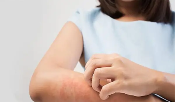 بیماری سلیاک چیست؟