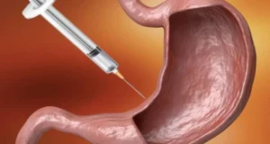 بوتاکس معده یا آمپول لاغزی؟
