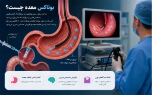 بوتاکس معده چیست؟