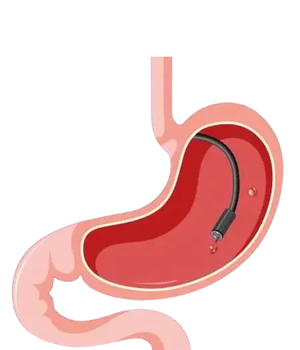 آندوسکوپی و کلونوسکوپی