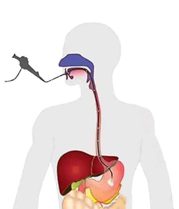 بوتاکس معده